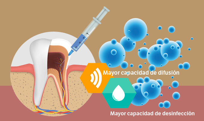 Tractament intracanal d’endodòncia