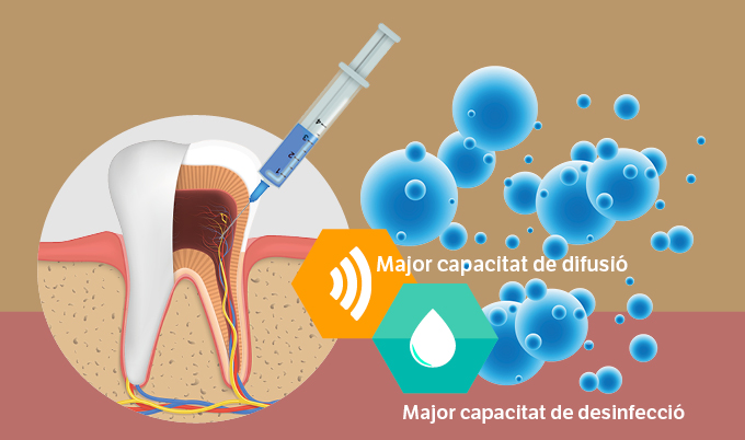 Tractament intracanal d’endodòncia