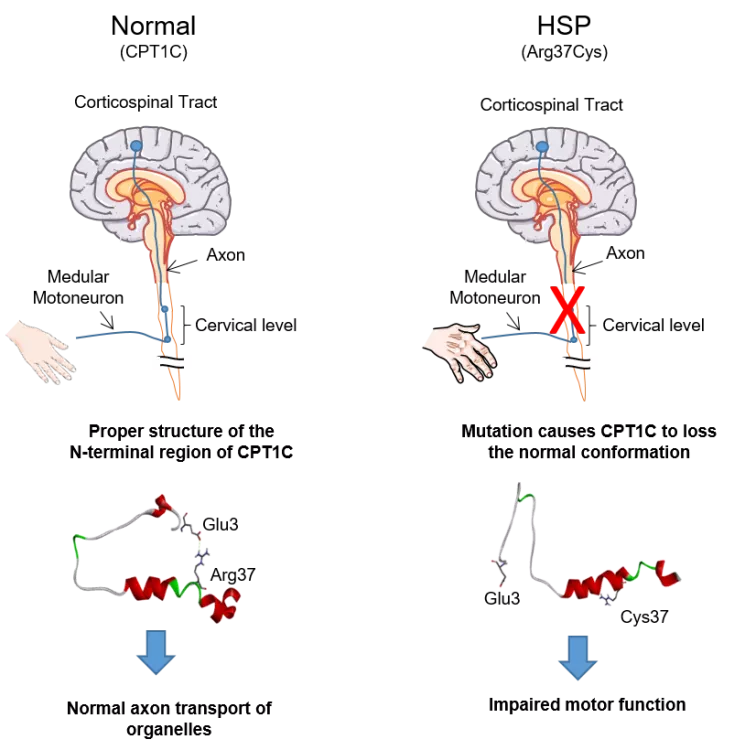El transport axonal en la paraplegia hereditària espàstica