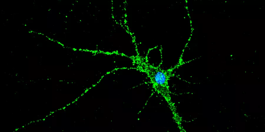 Regulació metabòlica de la funció sinàptica i la cognició
